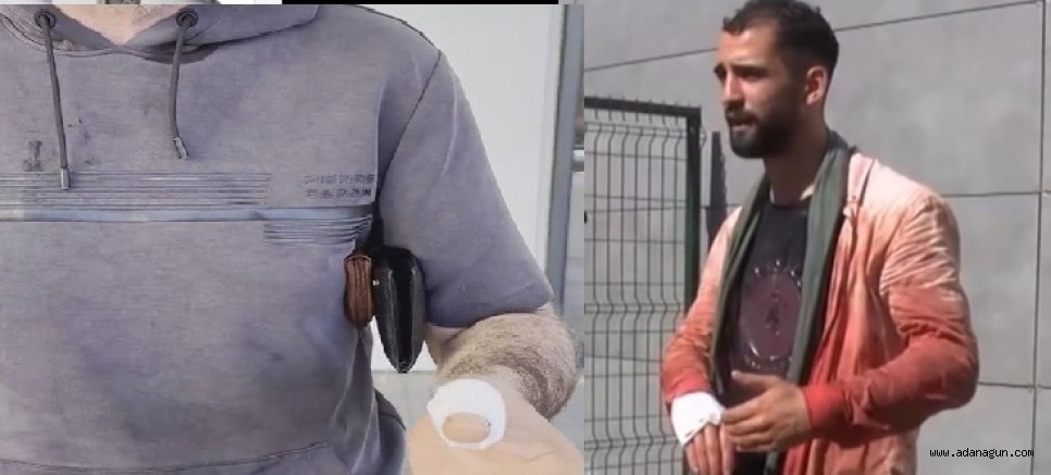 Acemi kasaplar yine kendilerini kesti