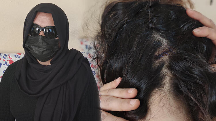 Alacağını istediği arkadaşının eşi tahrayla saldırdı!