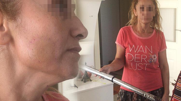 Ayrılığı kabullenemeyen sevgilisi elektrik süpürgesiyle dövdü!