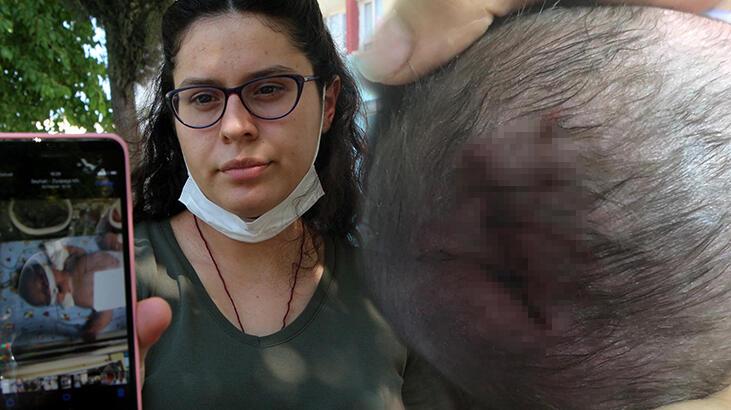 Doğum sırasında skandal! Düşürülen bebek ölüm kalım savaşı veriyor