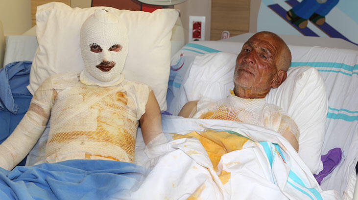 Erzurum'da feci olay! Aynı gün farklı bölgelerdeki 2 çobana yıldırım düşmesinde yaralandı