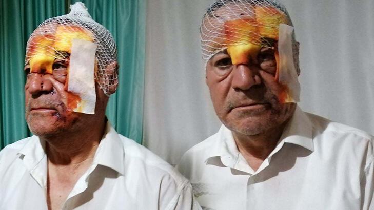 Minibüsçü ilçe başkanına sopalı saldırı!