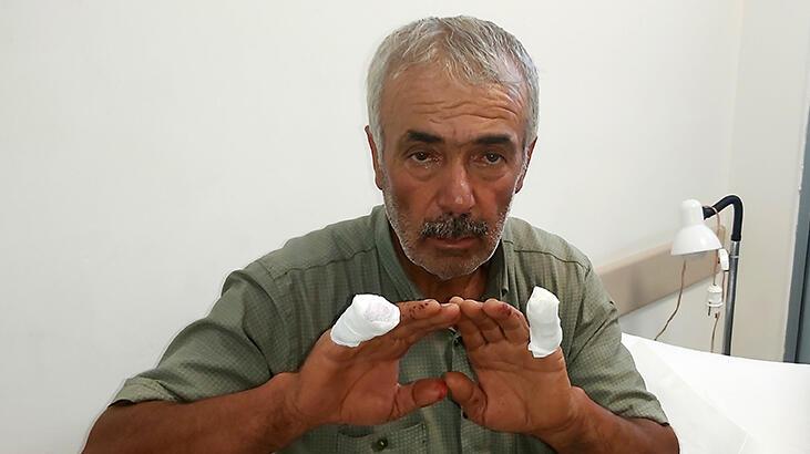 Parmağını kopartan kurdun başına taşla vurup uzaklaştırdı