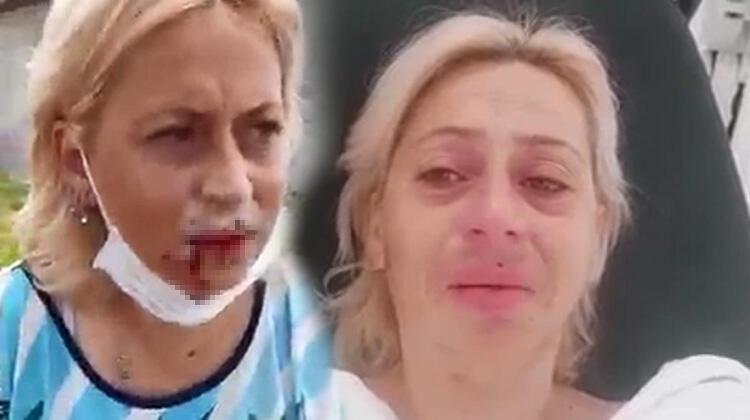 Sokak hayvanlarını beslerken saldırıya uğradı