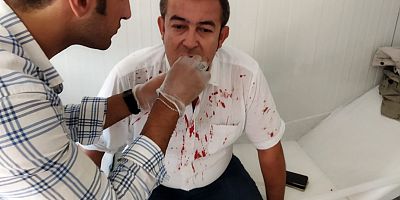GAZETECİYE SALDIRI KINANDI