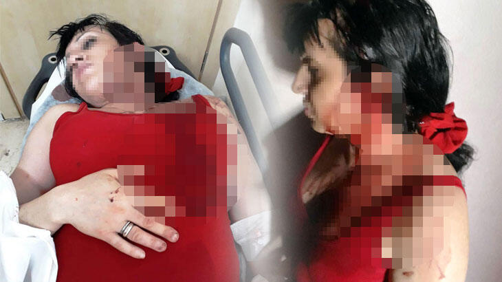 Trans bireyler arasında öldüresiye kavga! Beyzbol sopasıyla dövüldü